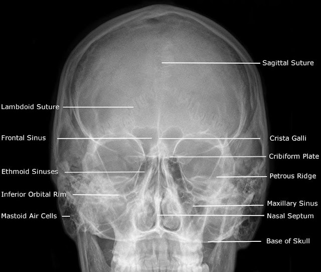 RxDentistry Radiographic Anatomy Of Facial Bones